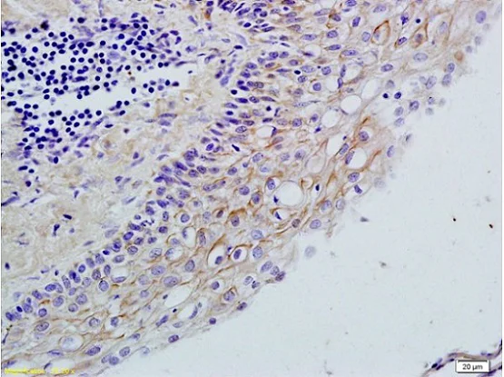 Immunohistochemistry (Formalin/PFA-fixed paraffin-embedded sections) - Anti-TLR2 antibody (AB213676)