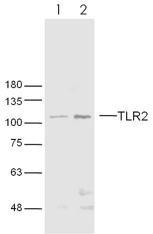 Western blot - Anti-TLR2 antibody (AB213676)