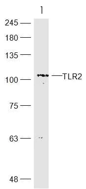 Western blot - Anti-TLR2 antibody (AB213676)