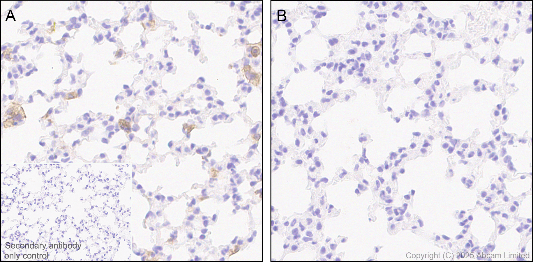 Immunohistochemistry (Formalin/PFA-fixed paraffin-embedded sections) - Anti-TLR2 antibody [EPR20302-119] (AB209216)