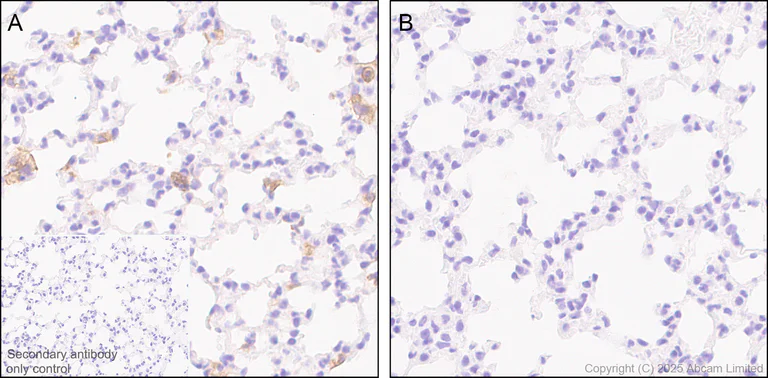 Immunohistochemistry (Formalin/PFA-fixed paraffin-embedded sections) - Anti-TLR2 antibody [EPR20302-119] (AB209216)