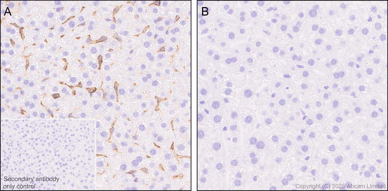Immunohistochemistry (Formalin/PFA-fixed paraffin-embedded sections) - Anti-TLR2 antibody [EPR20302-119] (AB209216)