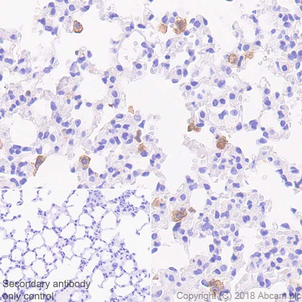 Immunohistochemistry (Formalin/PFA-fixed paraffin-embedded sections) - Anti-TLR2 antibody [EPR20302-119] (AB209216), expandable thumbnail