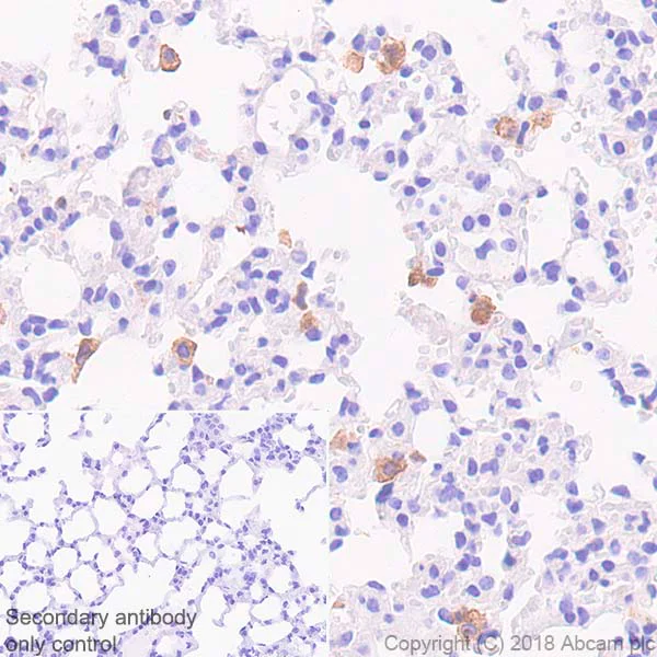 Immunohistochemistry (Formalin/PFA-fixed paraffin-embedded sections) - Anti-TLR2 antibody [EPR20302-119] (AB209216)