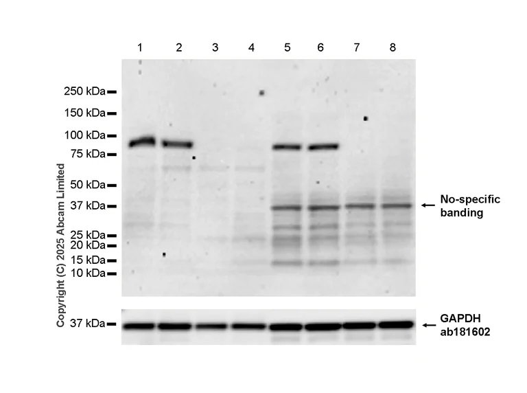 Western blot - Anti-TLR2 antibody [EPR20302-119] (AB209216)