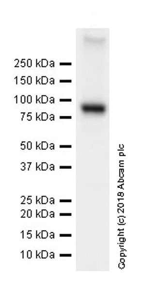 Western blot - Anti-TLR2 antibody [EPR20302-119] (AB209216), expandable thumbnail