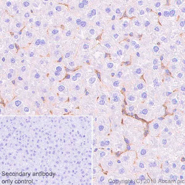 Immunohistochemistry (Formalin/PFA-fixed paraffin-embedded sections) - Anti-TLR2 antibody [EPR20302-119] - BSA and Azide free (AB243291)