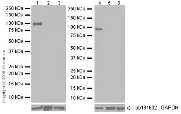 Western blot - Anti-TLR2 antibody [EPR20303] (AB209217)