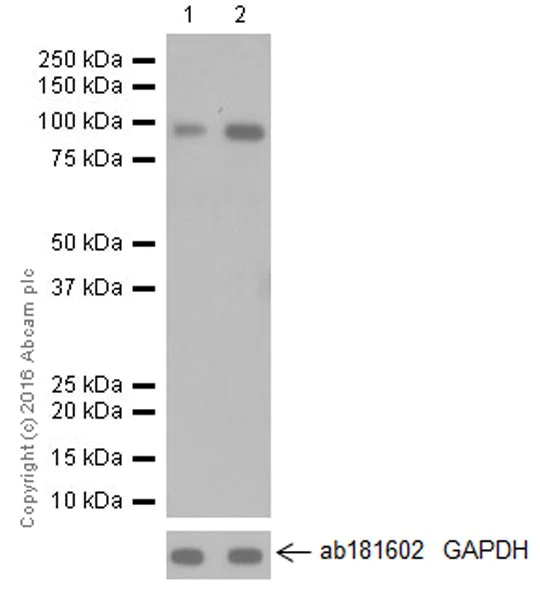 Western blot - Anti-TLR2 antibody [EPR20303] (AB209217)