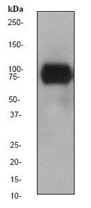 Western blot - Anti-TLR2 antibody [EPR2078Y] - BSA and Azide free (AB247367)