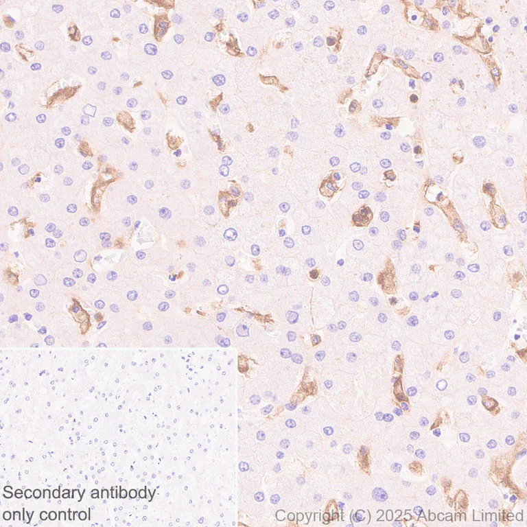 Immunohistochemistry (Formalin/PFA-fixed paraffin-embedded sections) - Anti-TLR2 antibody [EPR30565-520] (AB325499)