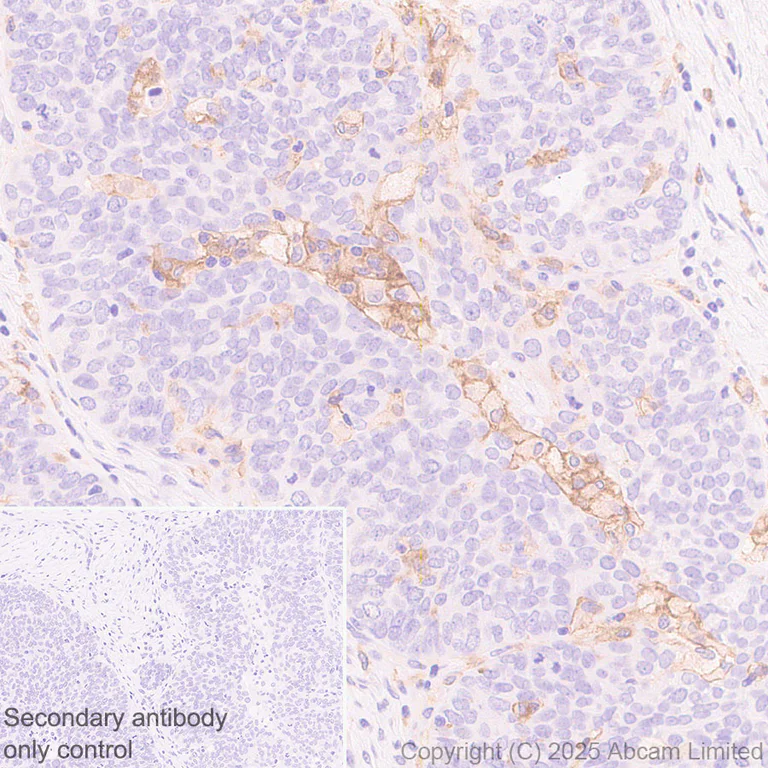 Immunohistochemistry (Formalin/PFA-fixed paraffin-embedded sections) - Anti-TLR2 antibody [EPR30565-520] (AB325499)