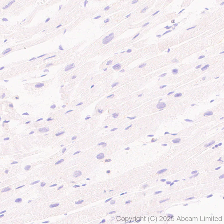 Immunohistochemistry (Formalin/PFA-fixed paraffin-embedded sections) - Anti-TLR2 antibody [EPR30565-520] (AB325499)