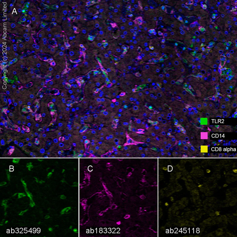 Multiplex immunohistochemistry - Anti-TLR2 antibody [EPR30565-520] (AB325499)