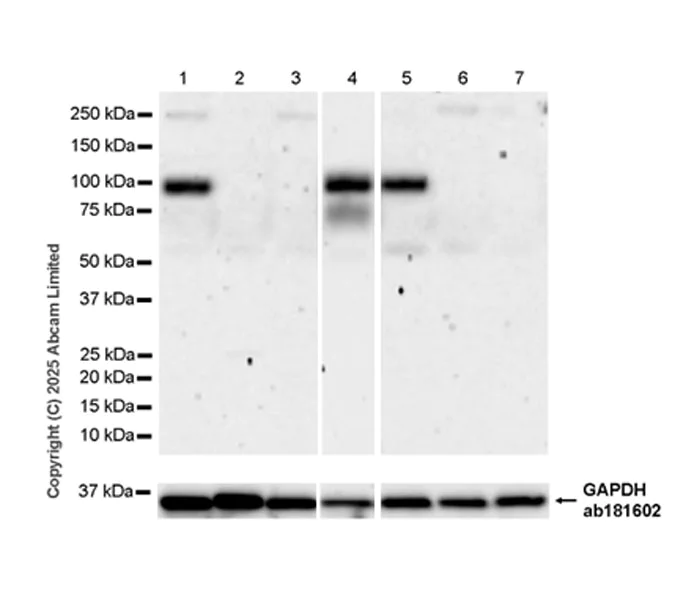 Western blot - Anti-TLR2 antibody [EPR30565-520] (AB325499)