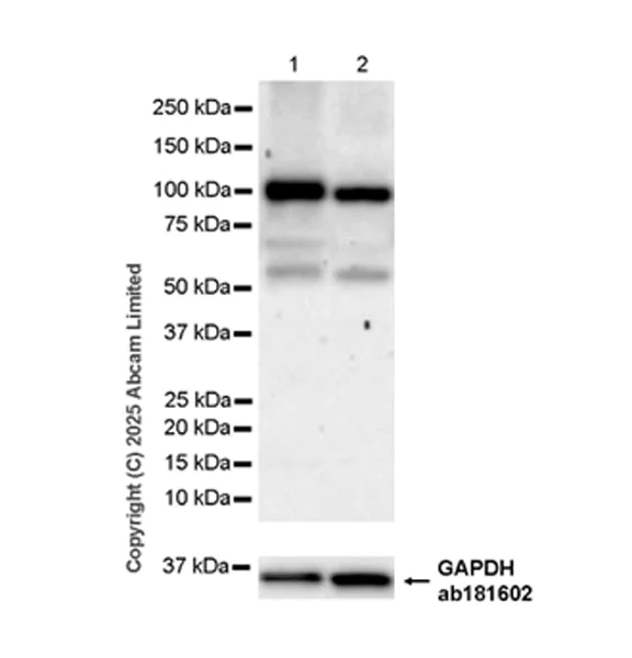Western blot - Anti-TLR2 antibody [EPR30565-520] (AB325499)