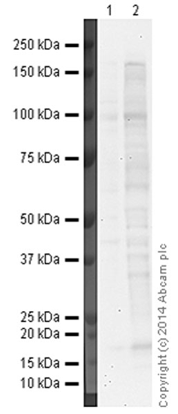 Western blot - Anti-TLR2 antibody [TL2.1] (AB9100)