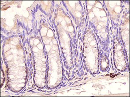 Immunohistochemistry (Formalin/PFA-fixed paraffin-embedded sections) - Anti-TLR3 antibody [40C1285] (AB13915)