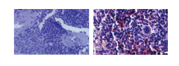 Immunohistochemistry (Formalin/PFA-fixed paraffin-embedded sections) - Anti-TLR3 antibody [40C1285] (AB13915)