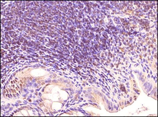 Immunohistochemistry (Formalin/PFA-fixed paraffin-embedded sections) - Anti-TLR3 antibody [40C1285] (AB13915)