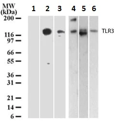 Western blot - Anti-TLR3 antibody [40C1285] (AB13915)