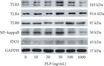 Western blot - Anti-TLR3 antibody [40C1285] (AB13915)