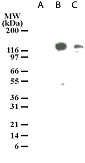 Western blot - Anti-TLR3 antibody [40C1285] (AB13915)