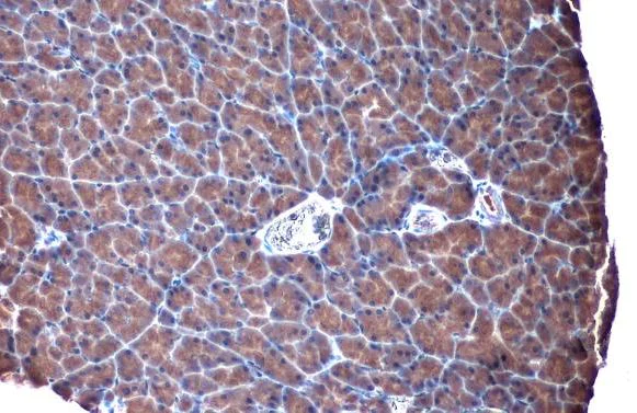 Immunohistochemistry (Formalin/PFA-fixed paraffin-embedded sections) - Anti-TLR3 antibody (AB137722)