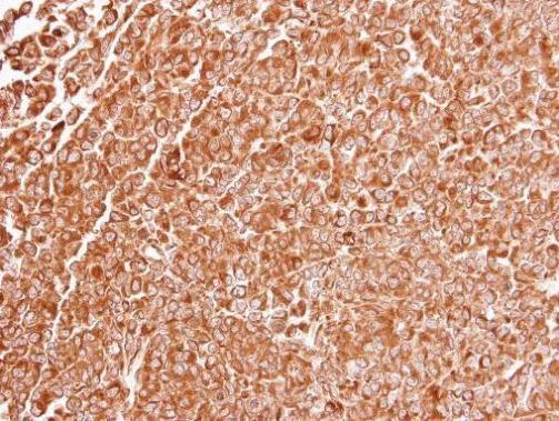 Immunohistochemistry (Formalin/PFA-fixed paraffin-embedded sections) - Anti-TLR3 antibody (AB137722)