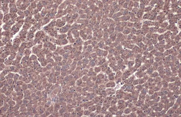 Immunohistochemistry (Formalin/PFA-fixed paraffin-embedded sections) - Anti-TLR3 antibody (AB137722)