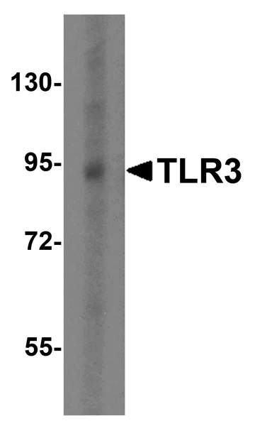Western blot - Anti-TLR3 antibody (AB62567)