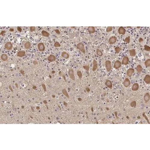 Immunohistochemistry (Formalin/PFA-fixed paraffin-embedded sections) - Anti-TLR3 antibody [HL2314] (AB317197)