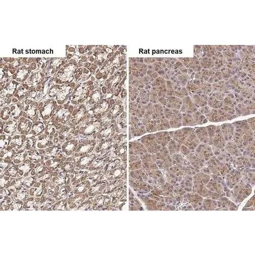 Immunohistochemistry (Formalin/PFA-fixed paraffin-embedded sections) - Anti-TLR3 antibody [HL2314] (AB317197)