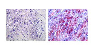 Immunohistochemistry (Formalin/PFA-fixed paraffin-embedded sections) - Anti-TLR4 antibody [76B357.1] (AB22048)