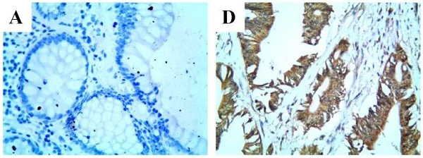 Immunohistochemistry (Formalin/PFA-fixed paraffin-embedded sections) - Anti-TLR4 antibody [76B357.1] (AB22048)
