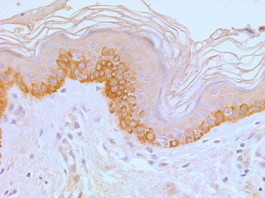 Immunohistochemistry (Formalin/PFA-fixed paraffin-embedded sections) - Anti-TLR4 antibody [76B357.1] (AB22048)