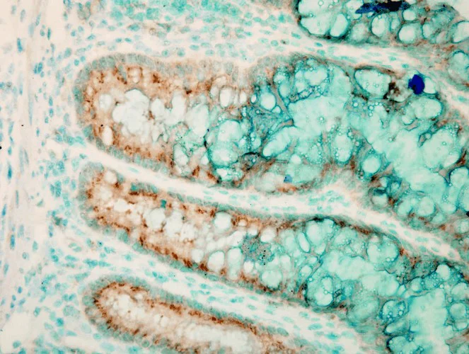 Immunohistochemistry (Formalin/PFA-fixed paraffin-embedded sections) - Anti-TLR4 antibody (AB13556)