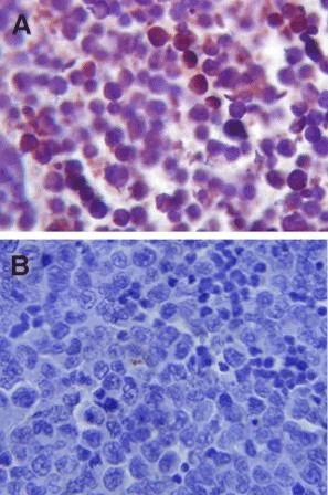 Immunohistochemistry (Formalin/PFA-fixed paraffin-embedded sections) - Anti-TLR4 antibody (AB13556)