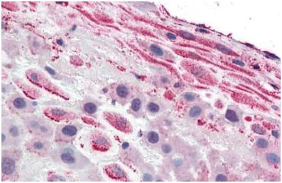 Immunohistochemistry (Formalin/PFA-fixed paraffin-embedded sections) - Anti-TLR4 antibody (AB150583)