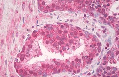 Immunohistochemistry (Formalin/PFA-fixed paraffin-embedded sections) - Anti-TLR4 antibody (AB218987)
