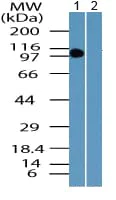 Western blot - Anti-TLR4 antibody (AB218987)