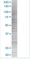 TLR4 overexpression 293T lysate (whole cell)