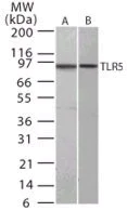 Western blot - Anti-TLR5 antibody [19D759.2] (AB13876)