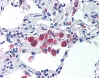 Immunohistochemistry (Formalin/PFA-fixed paraffin-embedded sections) - Anti-TLR5 antibody (AB115603)