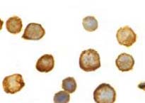 Immunocytochemistry/ Immunofluorescence - Anti-TLR5 antibody (AB37071)