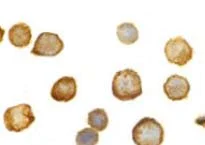 Immunocytochemistry/ Immunofluorescence - Anti-TLR5 antibody (AB37071)