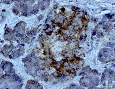Immunohistochemistry (Formalin/PFA-fixed paraffin-embedded sections) - Anti-TLR5 antibody (AB62460)