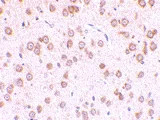 Immunohistochemistry (Formalin/PFA-fixed paraffin-embedded sections) - Anti-TLR5 antibody (AB62460)