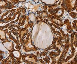 Immunohistochemistry (Formalin/PFA-fixed paraffin-embedded sections) - Anti-TLR6 antibody (AB197807)