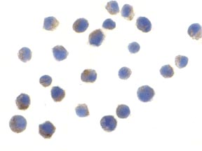Immunocytochemistry/ Immunofluorescence - Anti-TLR6 antibody (AB37072), expandable thumbnail